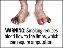 A rectangular cigarette health warning with a white background and black text that reads: "WARNING: Smoking reduces blood flow to the limbs, which can require amputation." Above the text is a photorealistic illustration showing the feet of a person who had several toes amputated due to tissue damage resulting from peripheral vascular disease caused by cigarette smoking. The warning is surrounded by a black outline. 