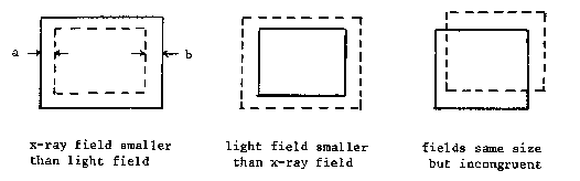 Common types of misalignments typical of x-ray systems