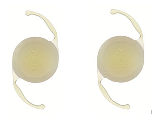 AcrySof® IQ PanOptix® Trifocal Intraocular Lens