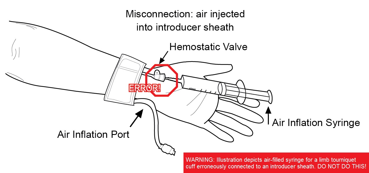 Misconnection: air injected into introducer sheath