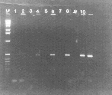 Photograph showing detection of HAV sequence in RNA isolated from clam tissue seeded with wild-type HAV.