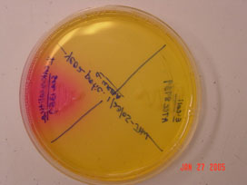 Christensen's Urea agar