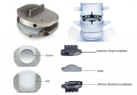 image of The prodisc L Total Disc Replacement  – P050010-S020