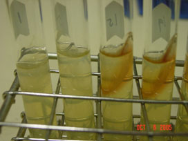 Pyrizinamidase test