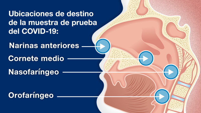 Ubicaciones de destino de la muestra de prueba del COVID-19: Narinas anteriores, Cornete medio, Nasofaríngeo, Orofaríngeo