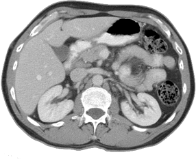 Cross sectional image of abdomen