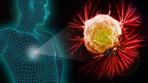 3D graphic of male upper body with exploded view of an electron micrograph of a breast cancer cell