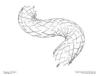 image of neuroform atlas stent system