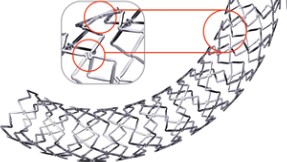 Drug Coated Cornary Stent