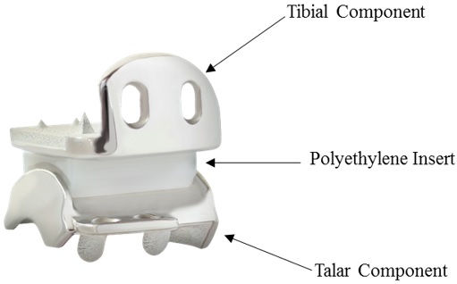 Diagram of the device, indicating tibial component, polyethylene insert, and talar component.