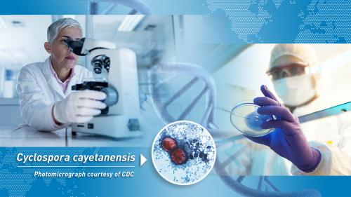 photo montage showing a scientist looking into microscope, a scientist preparing a sample in a Petri dish, a world map, a DNA double helix strand, and a photomicrograph of Cyclospora cayetanensis oocysts in a stool sample with text that reads Cyclospora cayetanensis photomicrograph courtesy of CDC