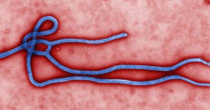 Transmission electron micrograph of an Ebola virus virion (image: CDC/Cynthia Goldsmith)