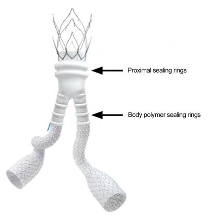 Image of Ovation iX Abdominal Stent Graft System indicating where the proximal sealing rings and the body polymer sealing rings are located on the device.