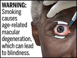A rectangular cigarette health warning with a white background and black text that reads: "WARNING: Smoking causes age-related macular degeneration, which can lead to blindness." To the right of the text is a photorealistic illustration depicting a closeup of an older man (aged 65 years or older) who has age-related macular degeneration caused by cigarette smoking. The man is receiving an injection in his right eye to prevent additional vessel growth. The warning is surrounded by a black outline. 