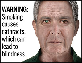A rectangular cigarette health warning with a white background and black text that reads: "WARNING: Smoking causes cataracts, which can lead to blindness." To the right of the text is a photorealistic illustration depicting a closeup of the face of a man (aged 65 years or older) who has a cataract caused by cigarette smoking. The man's right pupil is covered by a large cataract. The warning is surrounded by a black outline.
