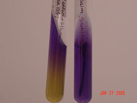Y. enterocolitica on MacConkey agar