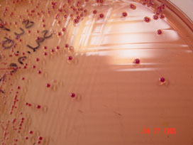 Y. enterocolitica colonies on YSA (CIN) agar