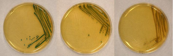 Cronobacter colonies on DFI agar