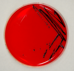 Cronobacter colonies on R&F agar (Ex. 1)