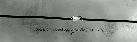 Figure V-11 EGG (NITS) OF THE HOG LOUSE ON HOG BRISTLES