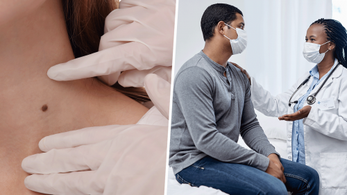 Left photo of doctor examine mole on patient. Right photo of doctor speaking with patient in exam room.