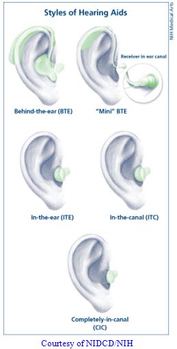 Styles of Hearing Aids