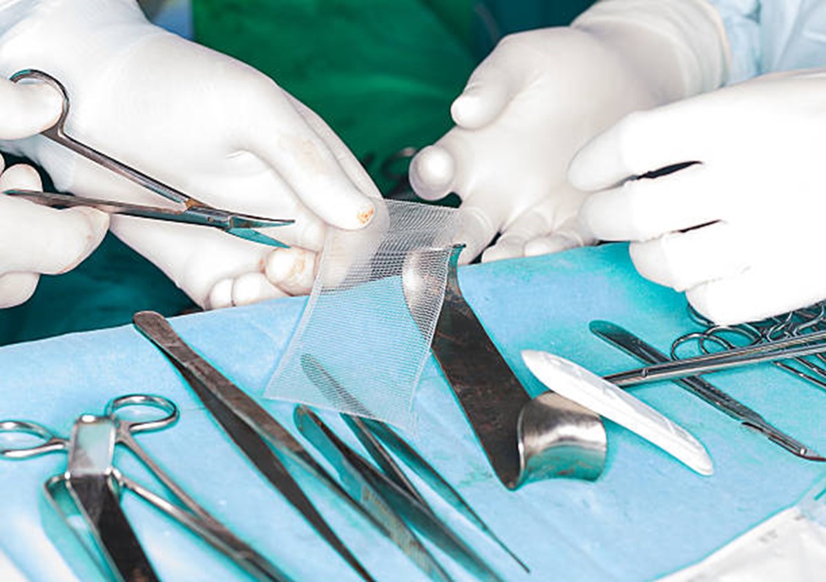 Two hands with white gloves; one hand holding surgical scissors and the opposite hand holding surgical mesh; surgical tools displayed in a surgical tray.