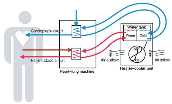 Image of a Heater-Cooler device