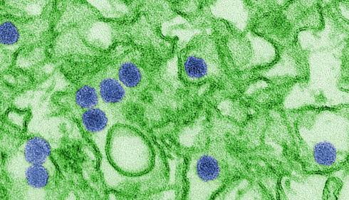 Digitally colorized transmission electron microscopic (TEM) image of Zika virus (Credit: CDC/Cynthia Goldsmith)