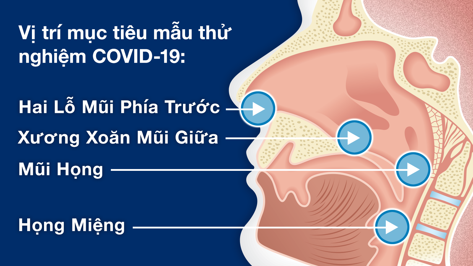 Vị trí mục tiêu mẫu thử nghiệm COVID-19: Hai Lỗ Mũi Phía Trước, Xương Xoăn Mũi Giữa, Mũi Họng, Họng Miệng