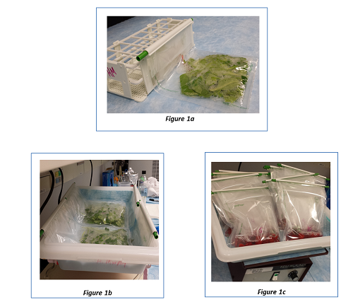 Detection of <em>Cyclospora cayetanenesis</em> in Produce