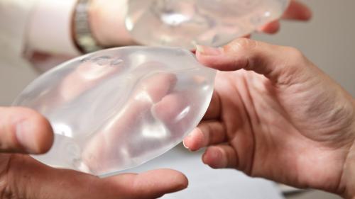 Closeup of doctor and patient hands holding and touching breast implants.