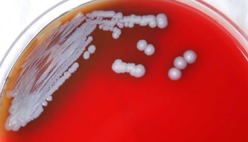 Burkholderia pseudomallei bacteria grown on a medium of sheep’s blood agar. B. pseudomallei is the bacterium responsible for causing melioidosis. (Credit: CDC/ Dr. Todd Parker, Audra Marsh)