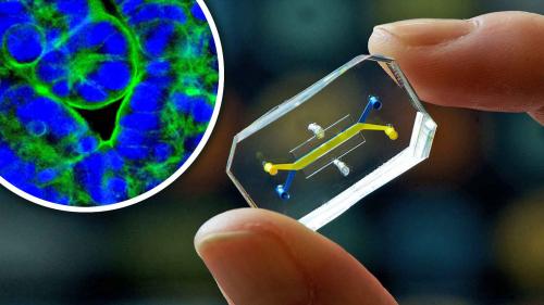 The Wyss Institute’s gut-on-a-chip constricts and relaxes, just as in the human body, producing finger-like projections called villi, shown at left. (Credit: Wyss Institute at Harvard University)  