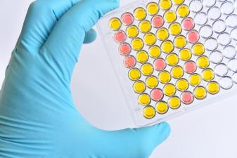 ELISA Plate Immunology Testing