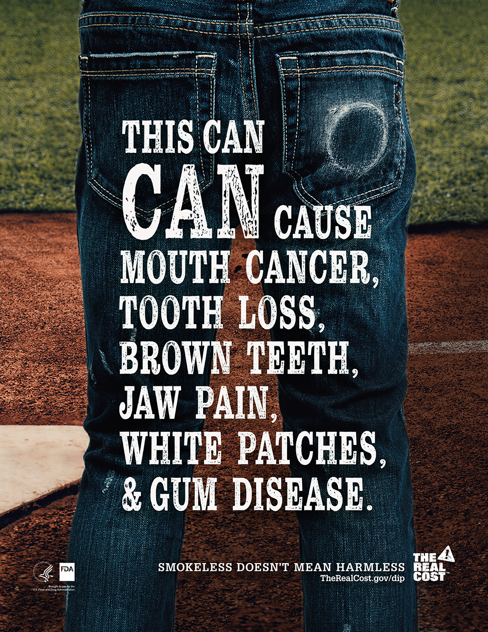 Smokeless tobacco poster - This can can cause mouth cancer, tooth loss, brown teeth, jaw pain, white patches and gum disease.