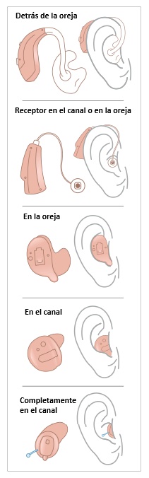 Tipos de audífonos 