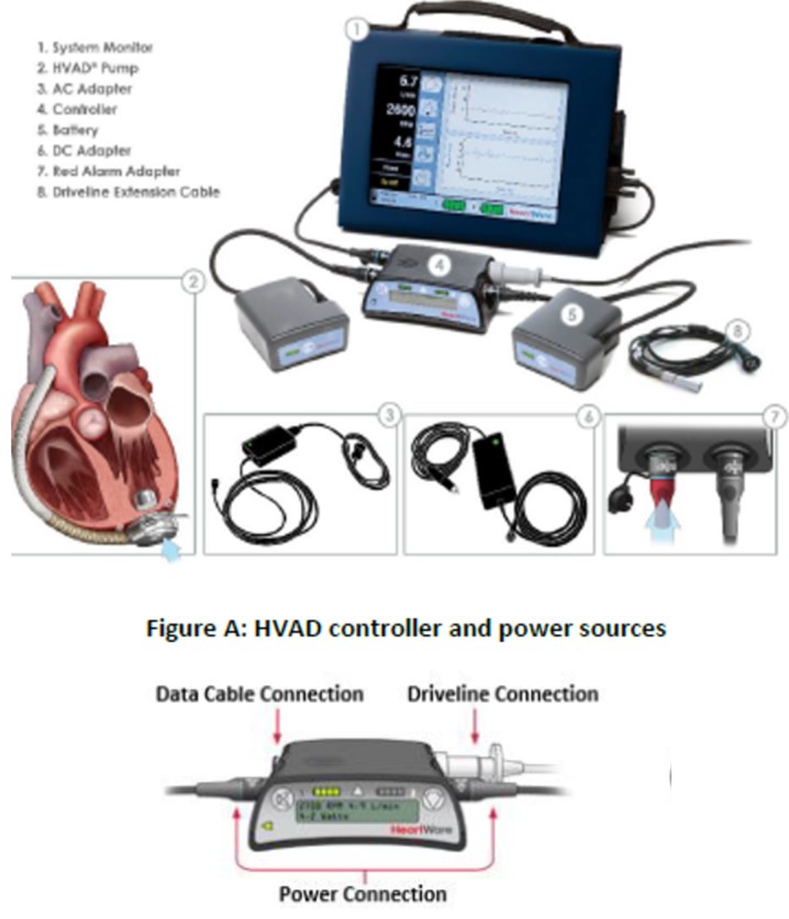 HeartWare HVAD System, showing the HVAD controller and power sources 