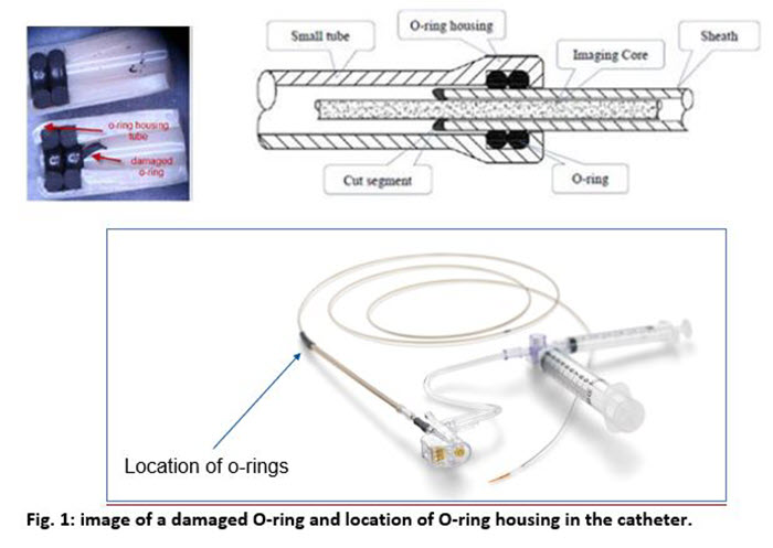 Fig. 1: image of a damaged O-ring and location of O-ring housing in the catheter.