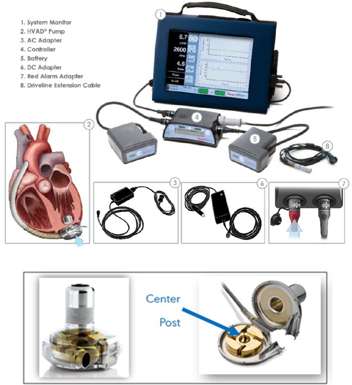 Image of the Medtronic HVAD Pump Implant Kit, indicating system monitor, HVAD pump, AC adapter, controller, battery, DC adapter, red alarm adapter, driveline extension cable, center, and post.