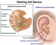Drawing of Hearing Aid