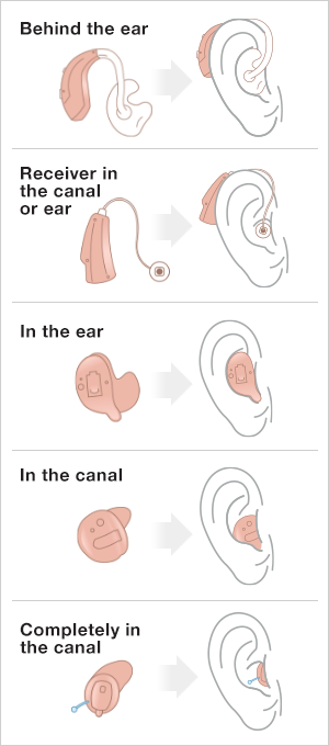 Styles of Hearing Aids: Behind the ear, Receiver in the canal or ear, In the ear, In the canal, and Completely in the canal