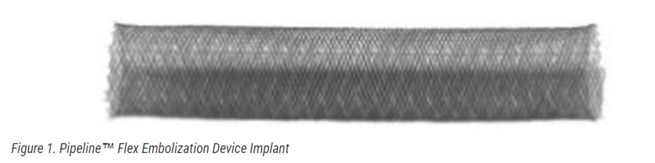 Pipeline Flex Embolization Device Implant