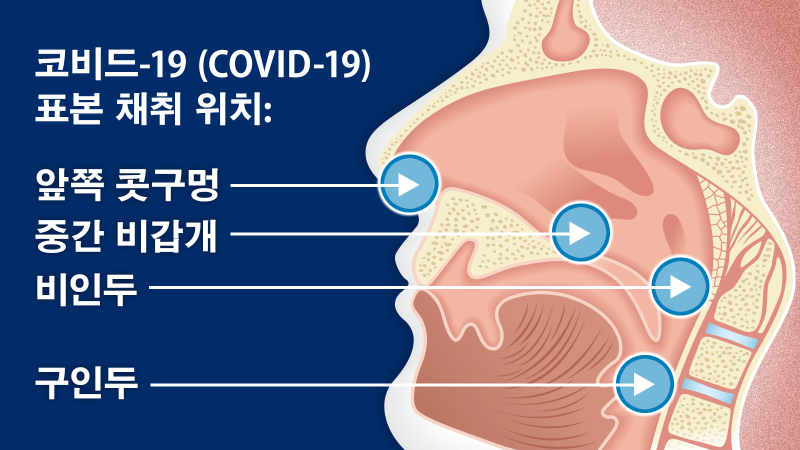 코비드-19 (COVID-19) 표본 채취 위치: 앞쪽 콧구멍, 중간 비갑개, 비인두, 구인두