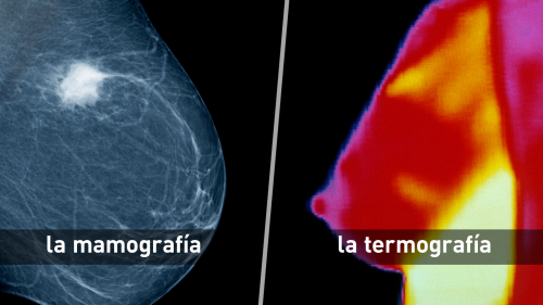 Una mamografía (L) es una imagen de rayos X del seno que puede identificar tipos de tejido con diferentes densidades, como masas dentro del seno. La termografía (R) produce una imagen infrarroja que muestra los patrones de calor en o cerca de la superficie del cuerpo.