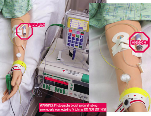 Epidural tubing erroneously connected to IV tubing on mannequin arm