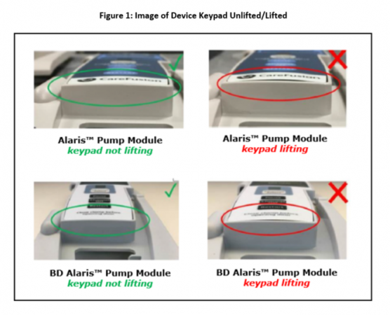 Image of the Alaris Pump Module and BD Alaris Pump Module, with and without the keypad lifting issue.