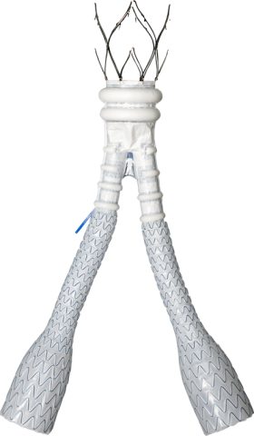 AltoTM Abdominal Stent Graft System