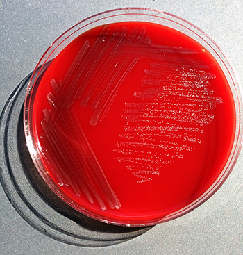 Plate of pertussis colonies