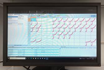 Endotoxin Testing Software_Theresa analyzing drug API (active pharmaceutical ingredients)